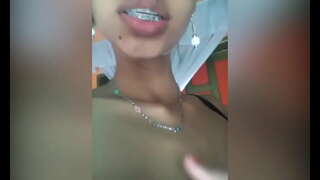 ���ுதிய உந்தப்பட்ட வீக்கம்